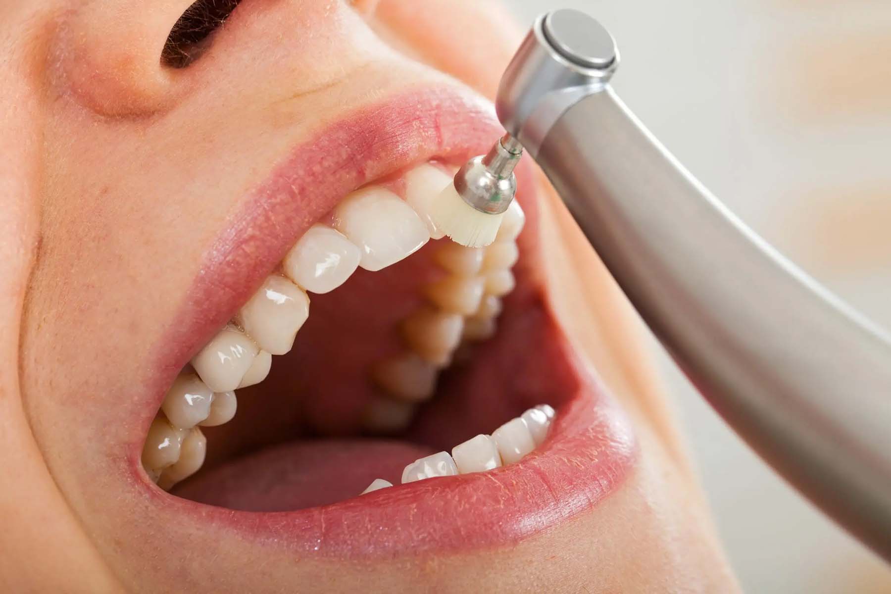 the-surprising-health-benefits-of-regular-dental-cleanings